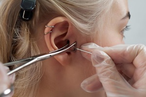 Meet Dr Ayub, Best surgeon for Earlobe Reduction in Cheadle, Uk